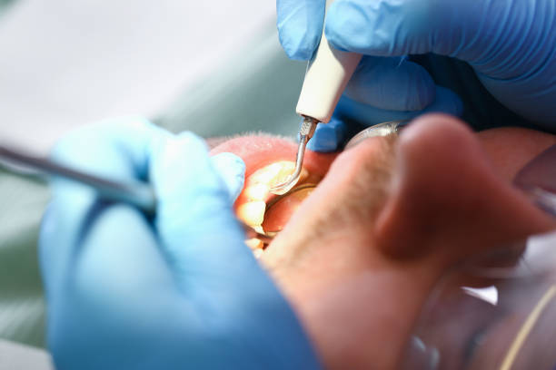 Best Emergency Treatment for Oral Infections in East Point, GA