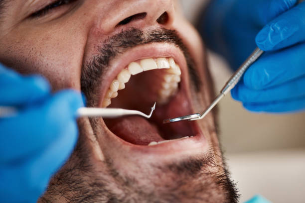 Best Emergency Cosmetic Dentistry (e.g., broken veneers) in East Point, GA